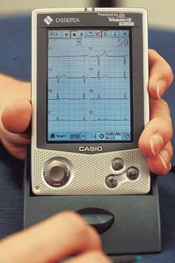 Cardio Perfect CE на основе Windows CE