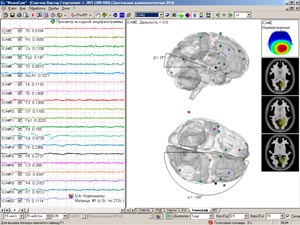 Локализация составляющей (20 kb)