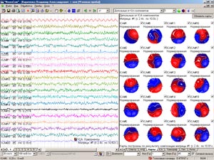 Дипольные карты ICA компонент (29 kb)